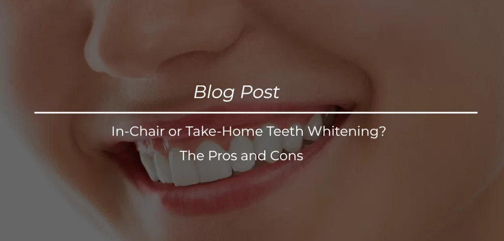 In-Chair or Take-Home Teeth Whitening