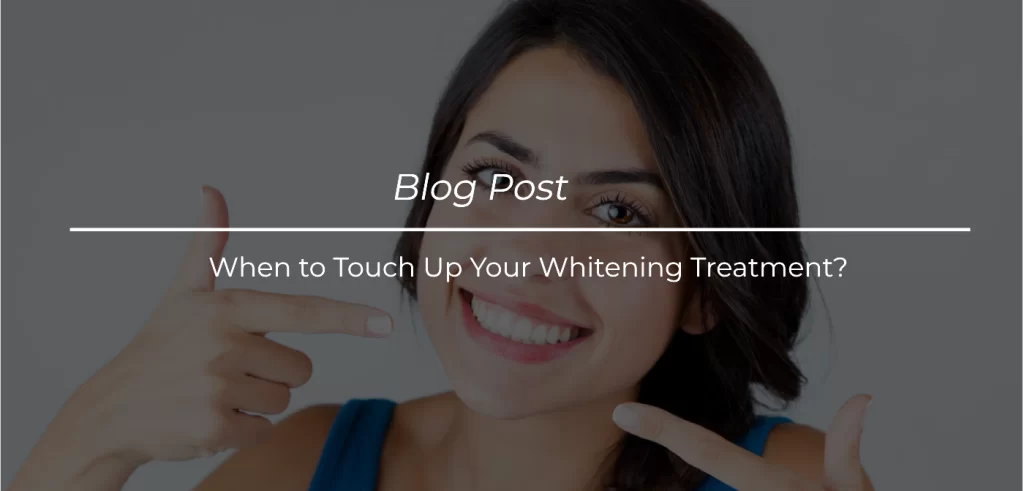 When to Touch Up Your Whitening Treatment_