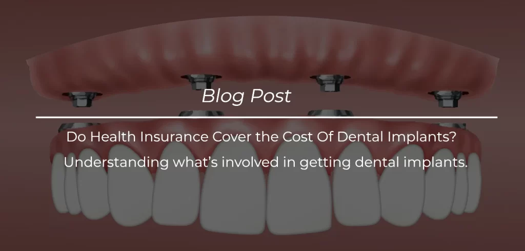 Do Health Insurance Cover the Cost Of Dental Implants_ Understanding what’s involved in getting dental implants.